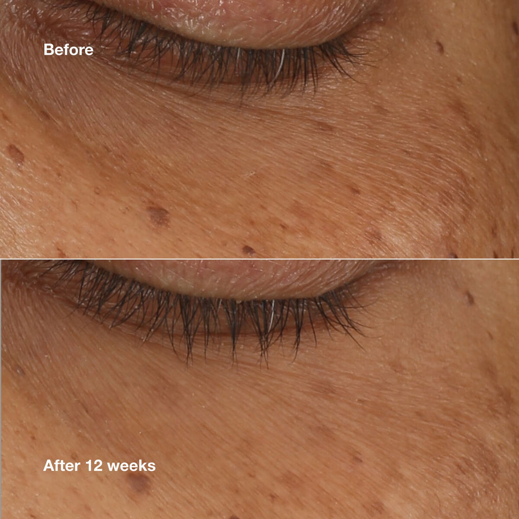 Illuminating Serum Clinique ALL ABOUT EYES 10 ml-4