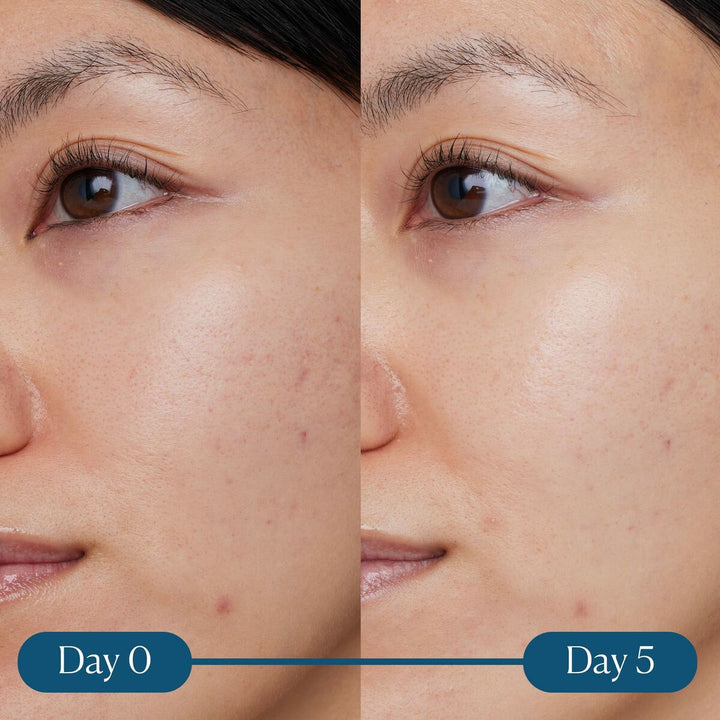 Facial Serum Elemis Dynamic Resurfacing 30 ml-3