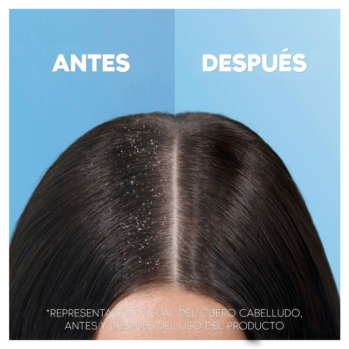 Shampoo Head & Shoulders H&S Clásico 1 L - Cosmova
