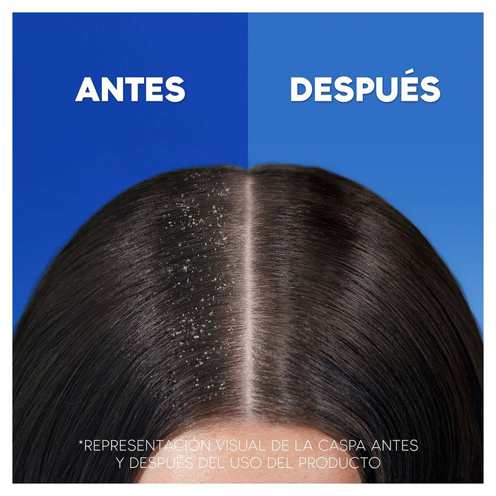 Shampoo Head & Shoulders S Anticaída 1 L - Cosmova