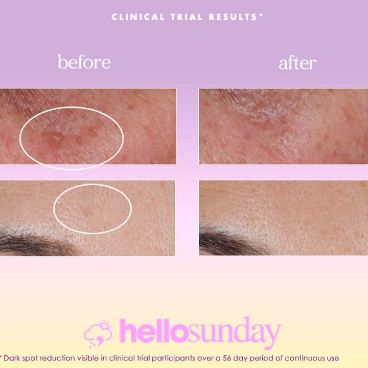 Facial Serum Hello Sunday The One That Makes You Glow Dark Spot SPF 40 (30 ml) - Cosmova